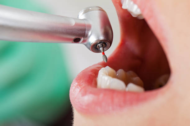 Best Pediatric Emergency Dentist in Gastonville, PA